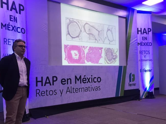 Afecta hipertensión arterial pulmonar a más de 3 mil mexicanos