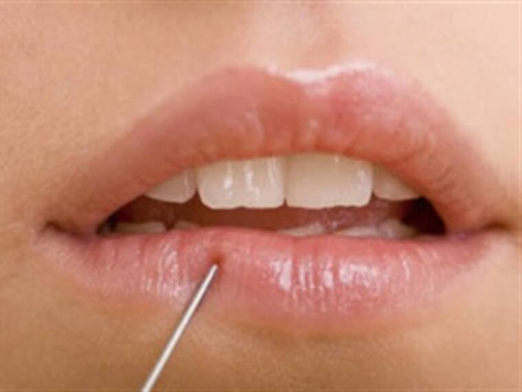 Descubre algunos procedimientos estéticos para los labios
