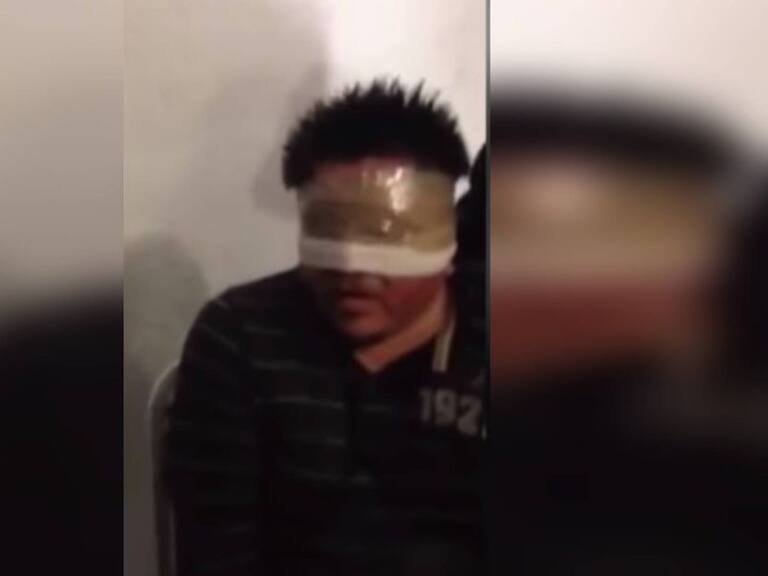 FGR investiga video que muestra tortura a detenido por caso Iguala