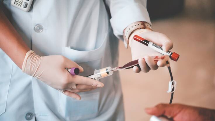 Anemia por deficiencia de vitamina B12 y ácido fólico