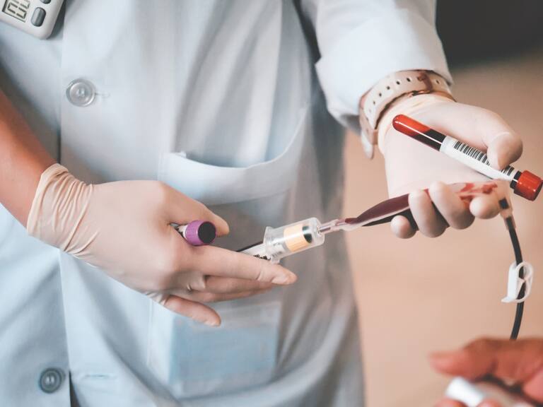 Anemia por deficiencia de vitamina B12 y ácido fólico