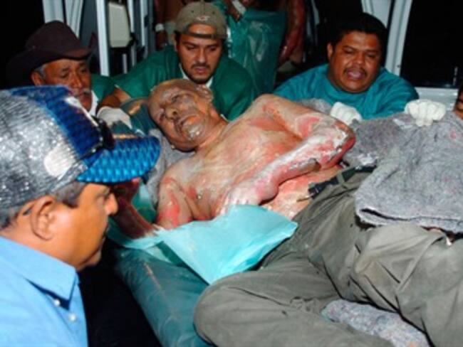 Apoyarán médicos forenses de México a víctimas de incendio en Honduras