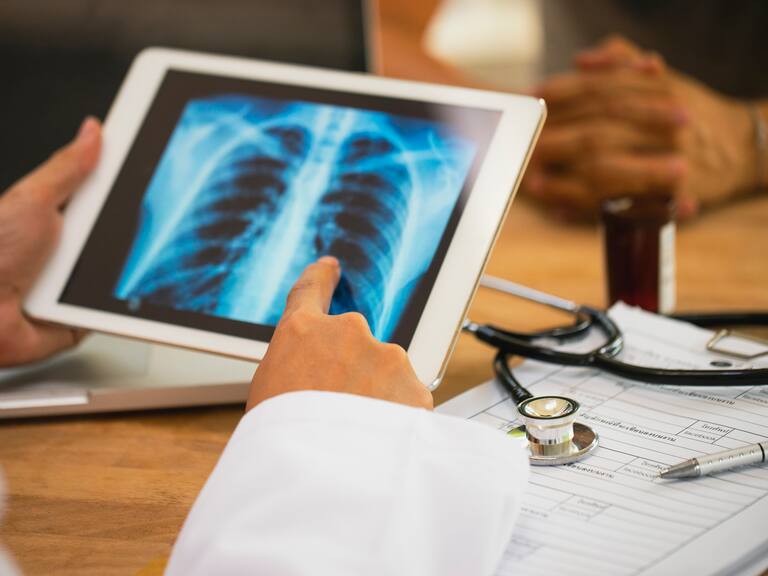 Hay menos casos de tuberculosis que el año pasado: Dr. Mauricio Rodríguez