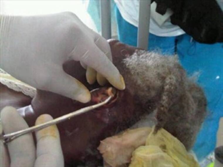 Médico mexicano ayuda en Haití 'por su cuenta'