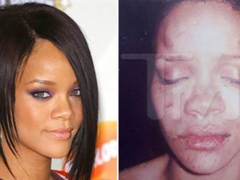 Investigan a policías por filtrar foto de Rihanna golpeada
