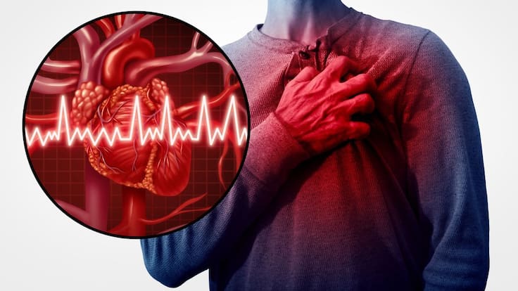 5 señales de que te está dando un infarto