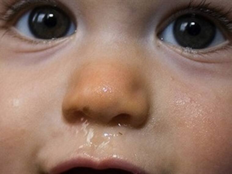 Si el niño tiene demasiado moco y no lo alivias, ¿qué hacer?