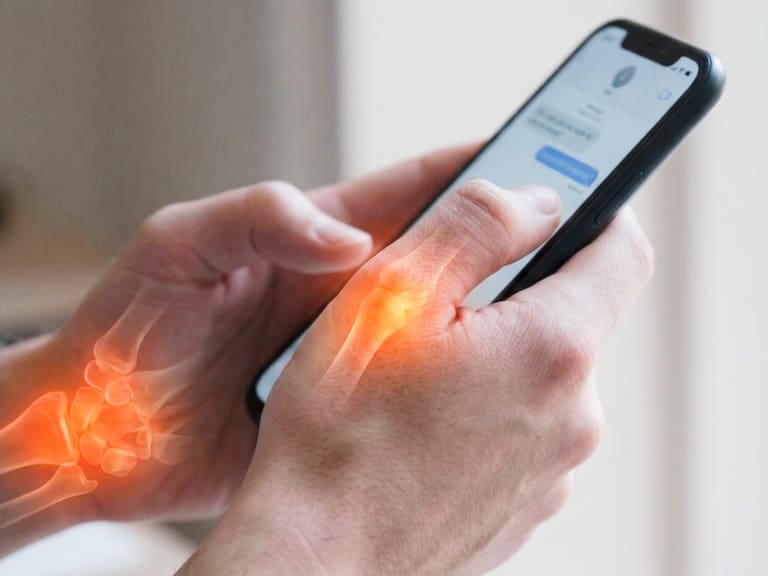 El uso prolongado del celular puede provocar dolor en la base del pulgar y favorecer lesiones en tendones y articulaciones de la mano.