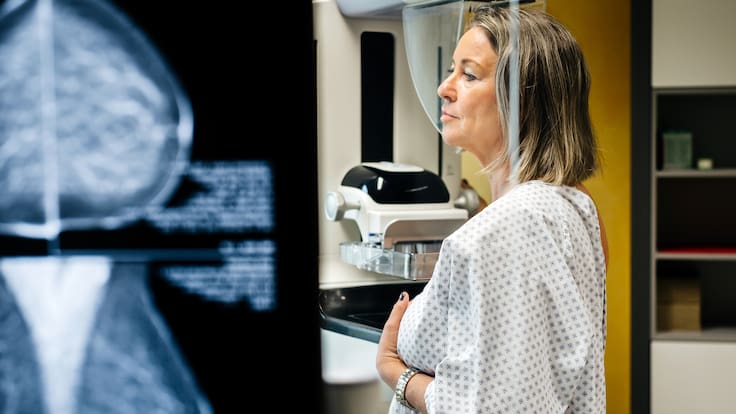 Vacunas contra el cáncer de mama: ¿La cura definitiva o una esperanza lejana?