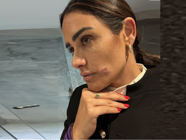 Alcaldesa de Cuauhtémoc denuncia agresión durante recorrido nocturno en la Zona Rosa