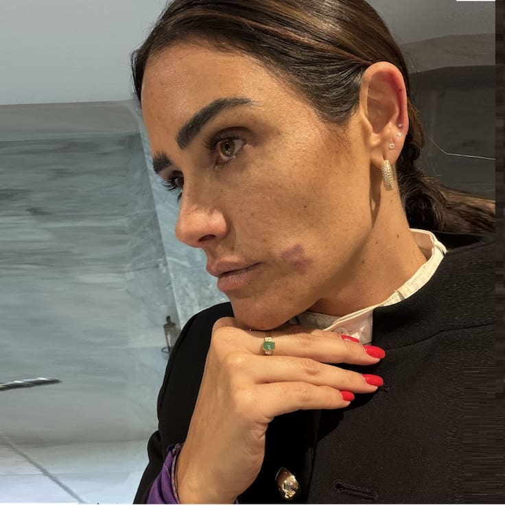 Alcaldesa de Cuauhtémoc denuncia agresión durante recorrido nocturno en la Zona Rosa