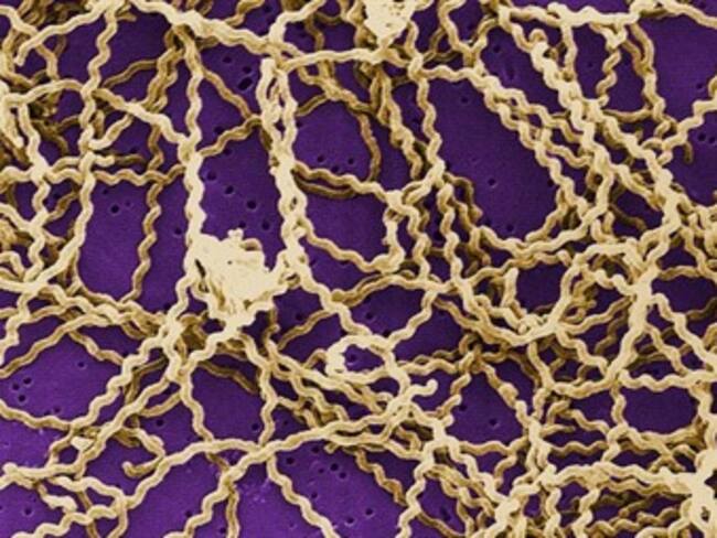 Se extiende leptospirosis por Centroamérica