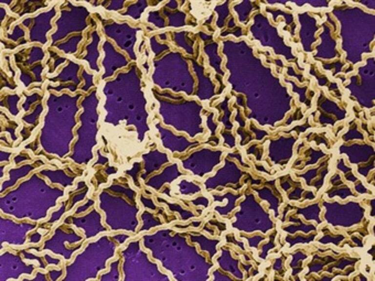 Se extiende leptospirosis por Centroamérica