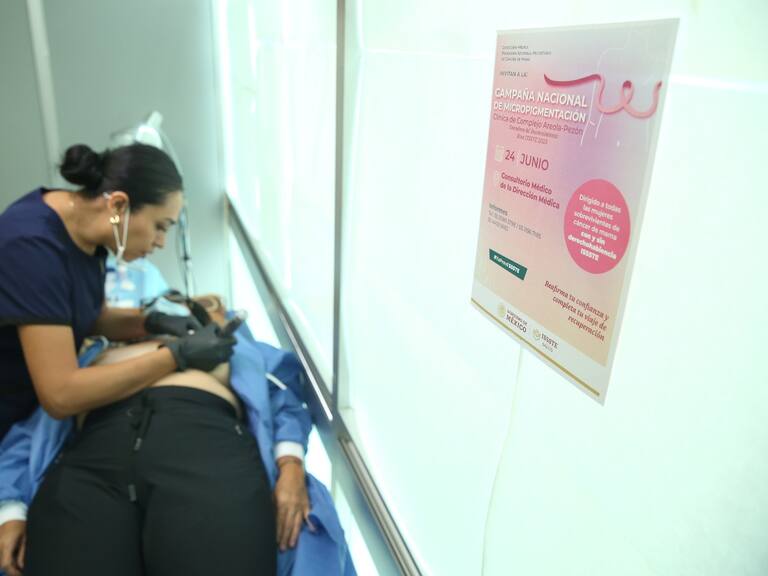 Issste ofrece micropigmentación de areola-pezón para todas las mujeres que superaron cáncer