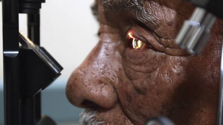 Anuncian cirugías de cataratas GRATIS en todo México: Requisitos y cómo registrarse