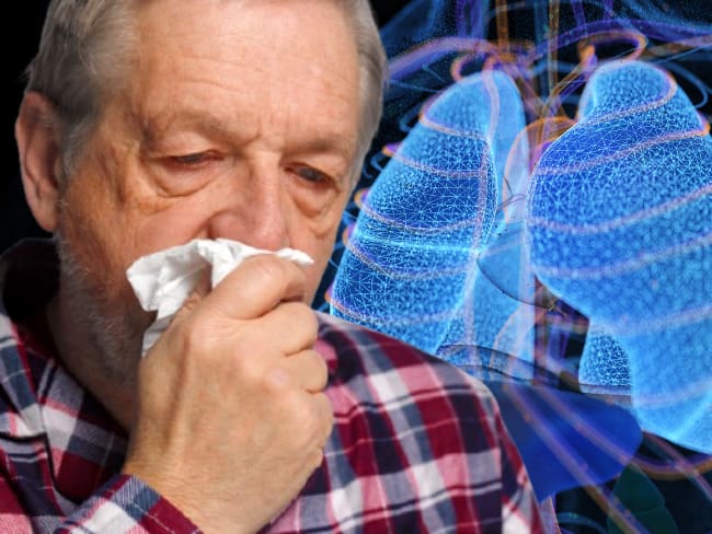 Tuberculosis en México supera los mil casos en 2026 en medio de la ola por sarampión: estados y síntomas