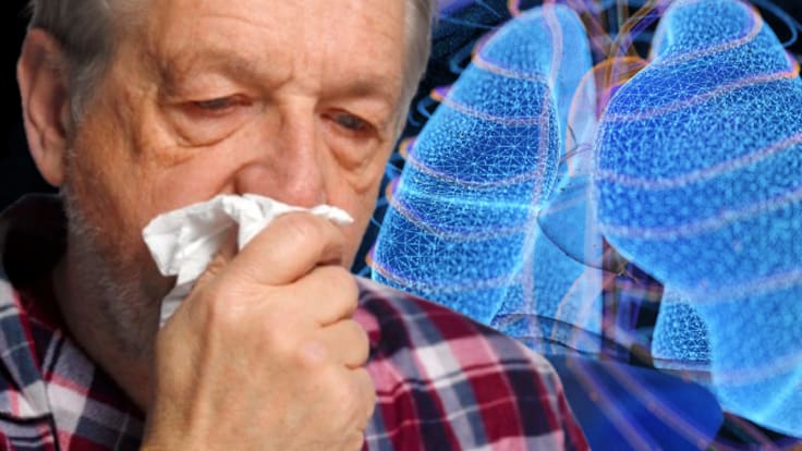 Tuberculosis en México supera los mil casos en 2026 en medio de la ola por sarampión: estados y síntomas