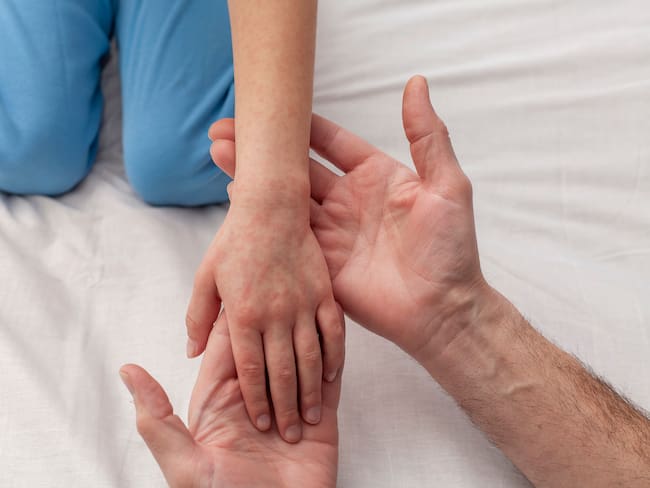 ¡No es solo un sarpullido! Academia de Pediatría advierte riesgos mortales del sarampión