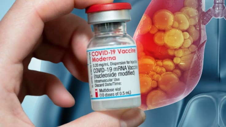 ¿Hay presunta relación entre el cáncer y la vacuna contra el Covid de Pfizer y Moderna? Esto revela un estudio
