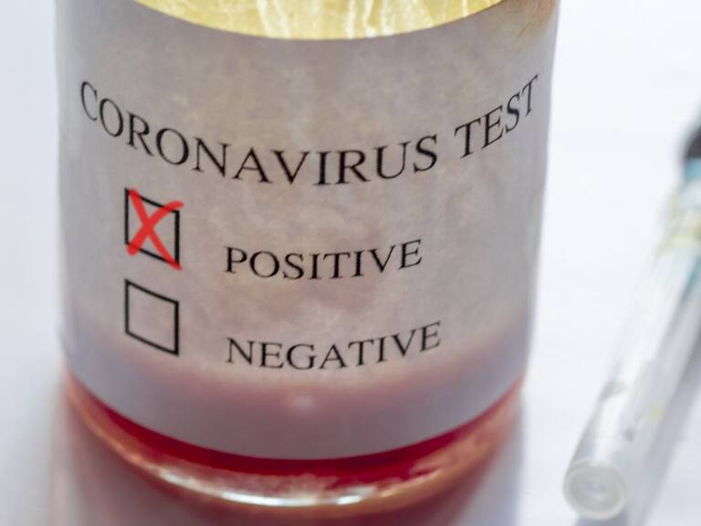 Casos de reinfección por coronavirus: Hong Kong, Holanda y Bélgica