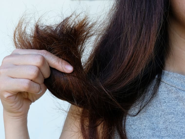 Caída de pelo, ¿Cómo evitar que se siga adelgazando?