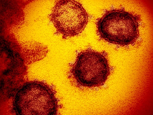 COVID-19: Detectan variante de coronavirus al sur de Inglaterra