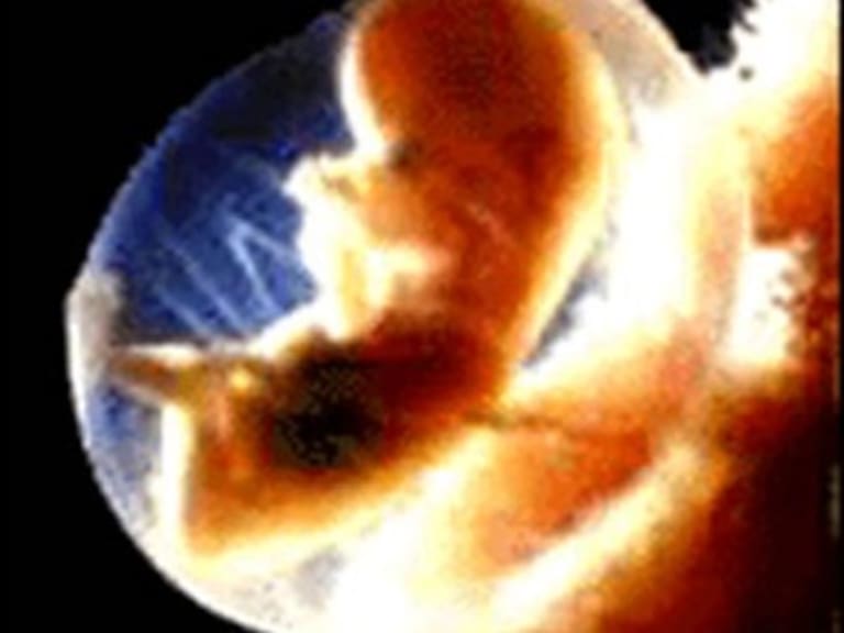 Aborto espontáneo no debe castigarse: Córdova