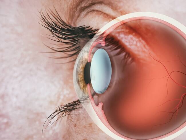 Enfermedades de la retina