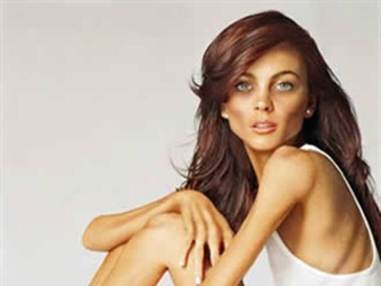 Adolescentes en París comen algodón para adelgazar: Jean Piña