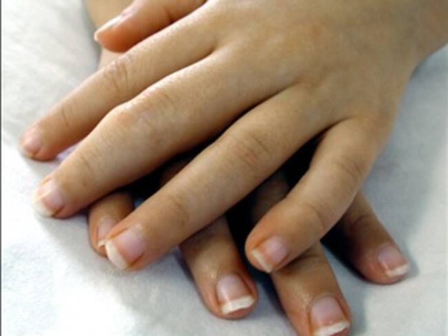 ¿Sabías que la artritis juvenil es más frecuente en mujeres?