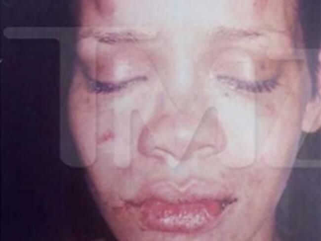 Detona investigación publicación de foto de Rihanna
