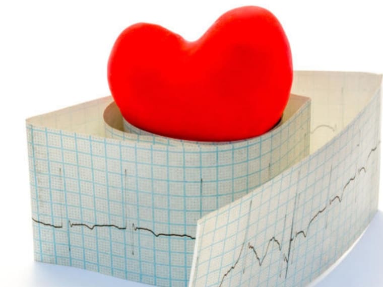 Taquicardia: Cuando el corazón se acelera