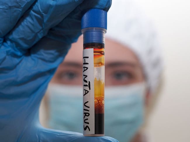 Hantavirus: ¿Por qué es falso que pueda permanecer seis años en el semen, según expertos?