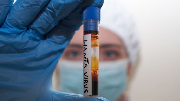 Hantavirus: ¿Por qué es falso que pueda permanecer seis años en el semen, según expertos?