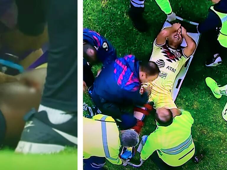 Giovani dos Santos sufre brutal lesión en el Clásico América contra Chivas