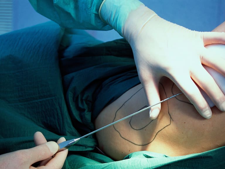 Mx - Necrocosmética, nueva cirugía estética en Estados Unidos
