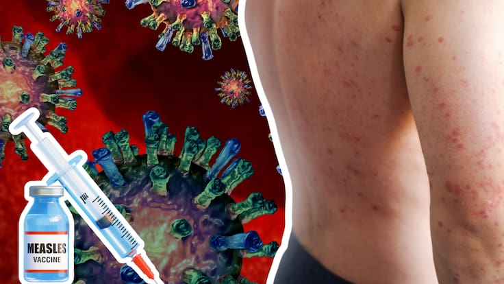 Sarampión: Lanzan página ‘¿Dónde me vacuno?’ con puntos actualizados de vacunación en todo el país