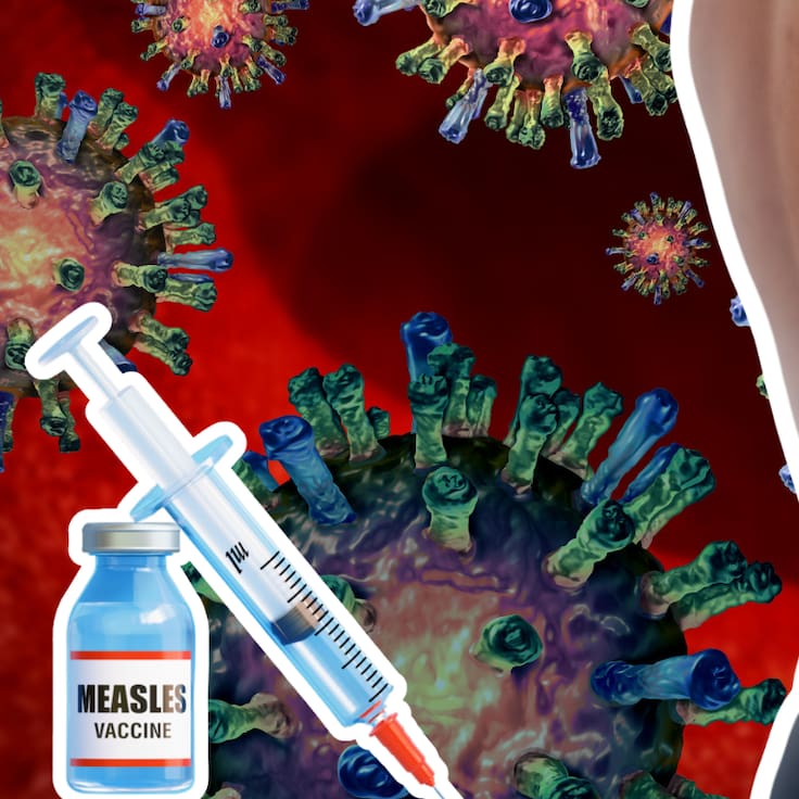 Sarampión: Lanzan página ‘¿Dónde me vacuno?’ con puntos actualizados de vacunación en todo el país