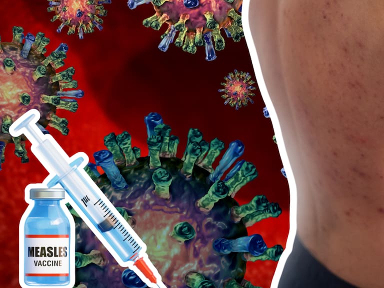 Vacunación Sarampión CDMX