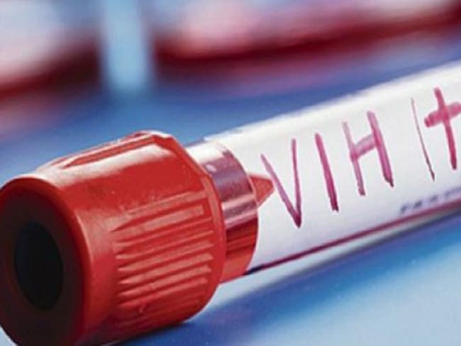 Urge Congreso incrementar medidas de prevención y control del VIH-SIDA
