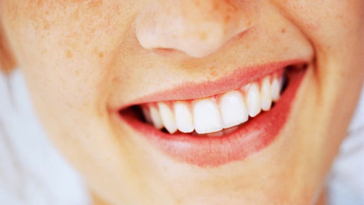 Hábitos que dañan tus dientes