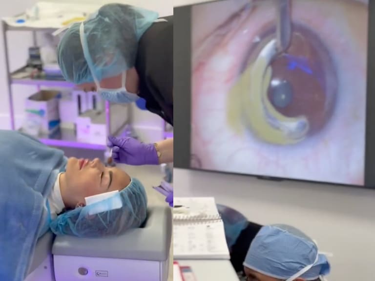 Ninel Conde cambió el color de sus ojos a verde olivo tras someterse a una cirugía de quiropigmentación.