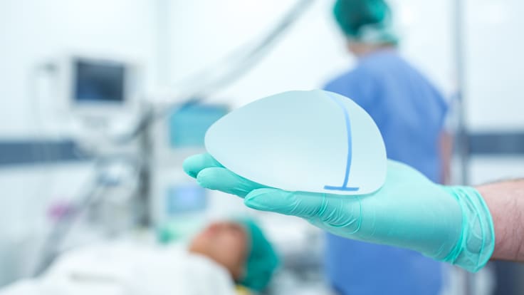 Justicia de Francia ordena indemnizar a 371 mujeres por implantes mamarios defectuosos