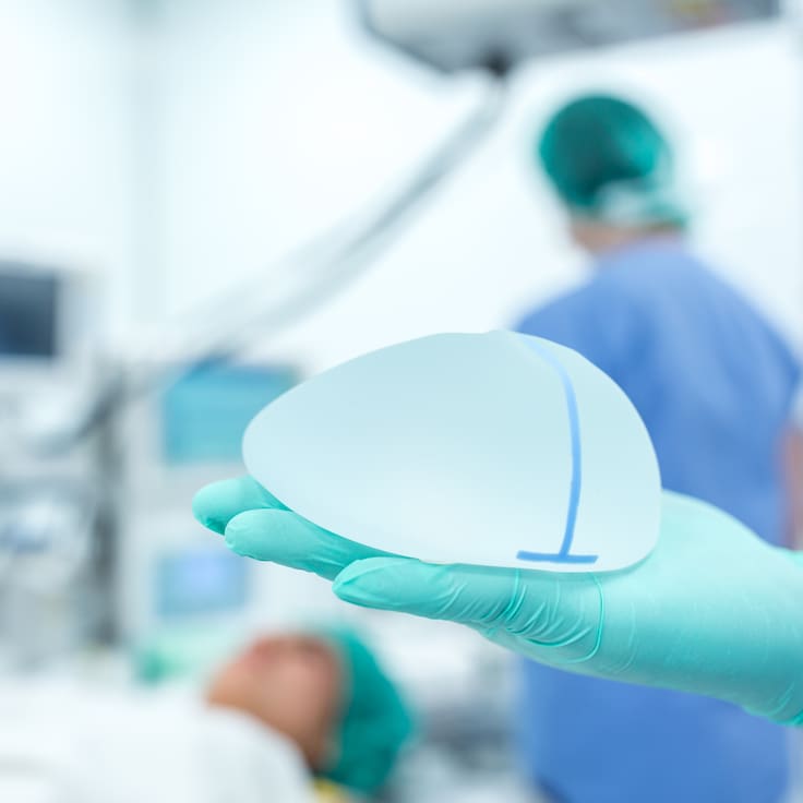 Justicia de Francia ordena indemnizar a 371 mujeres por implantes mamarios defectuosos