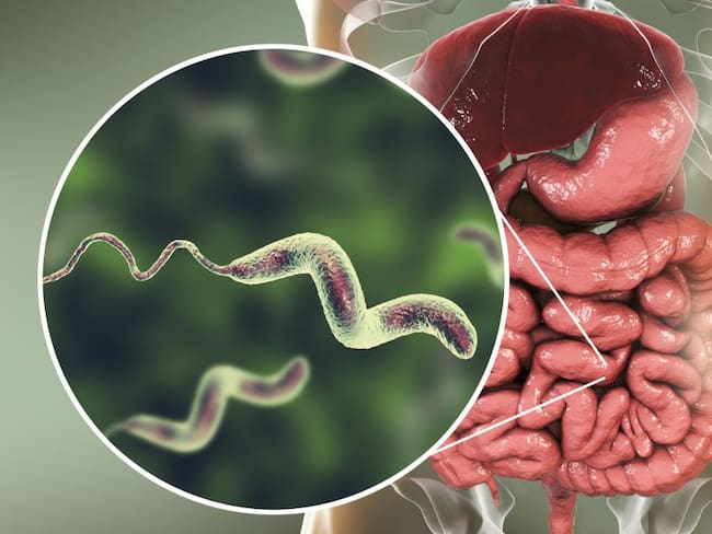 Gastroenteritis bacteriana, ¿qué es y cuáles son sus síntomas?