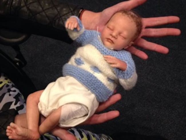 ¿Cuáles son las complicaciones que presenta un bebé prematuro?