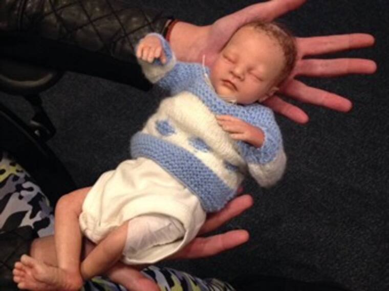 ¿Cuáles son las complicaciones que presenta un bebé prematuro?