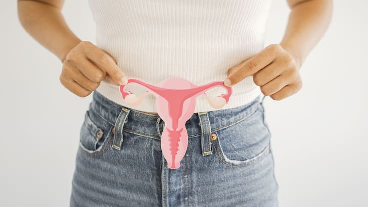 Ovario poliquístico cambiará de nombre: Esto es lo que significa para millones de mujeres
