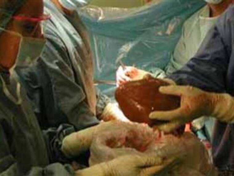 Causa falta de información miedo a donar órganos