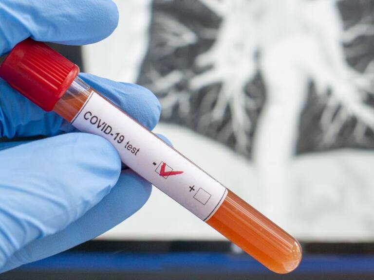 Confirma SSalud primera muerte de un paciente con coronavirus en México